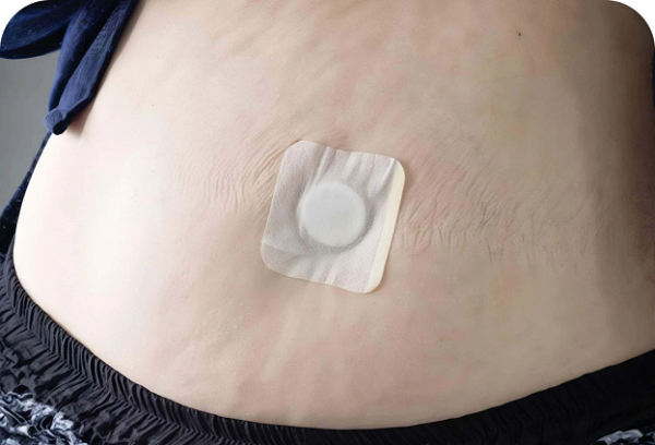 Lean Patch – Advanced Weight Loss Support Through Transdermal Technology - Image 4